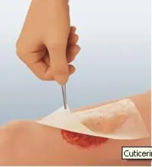 Cuticerin Gauze Dressing 3" x 8" [Box of 50]