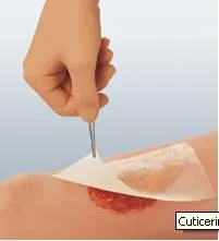 Cuticerin Gauze Dressing 3" x 8" [Box of 50]